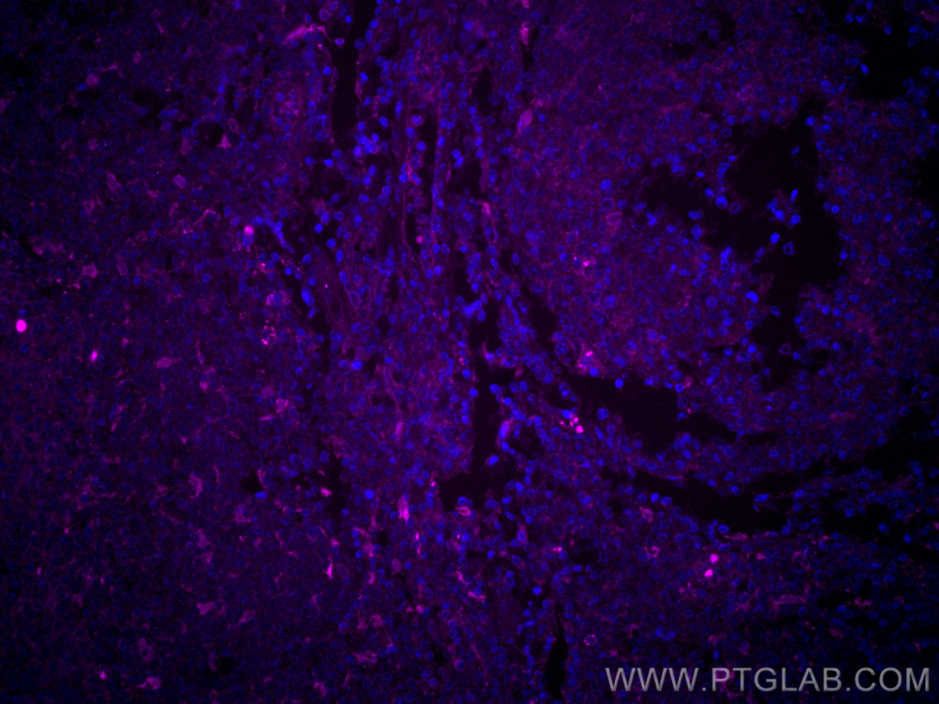 IF Staining of human tonsillitis using CL647-66321