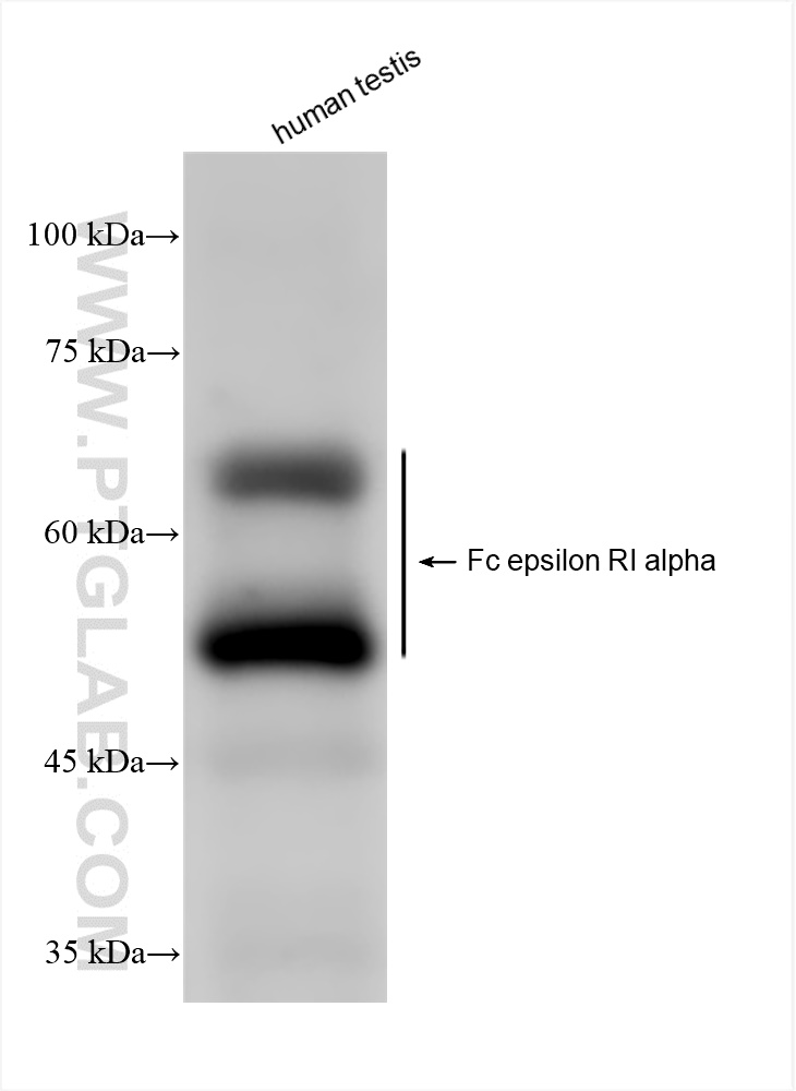 Fc epsilon RI alpha