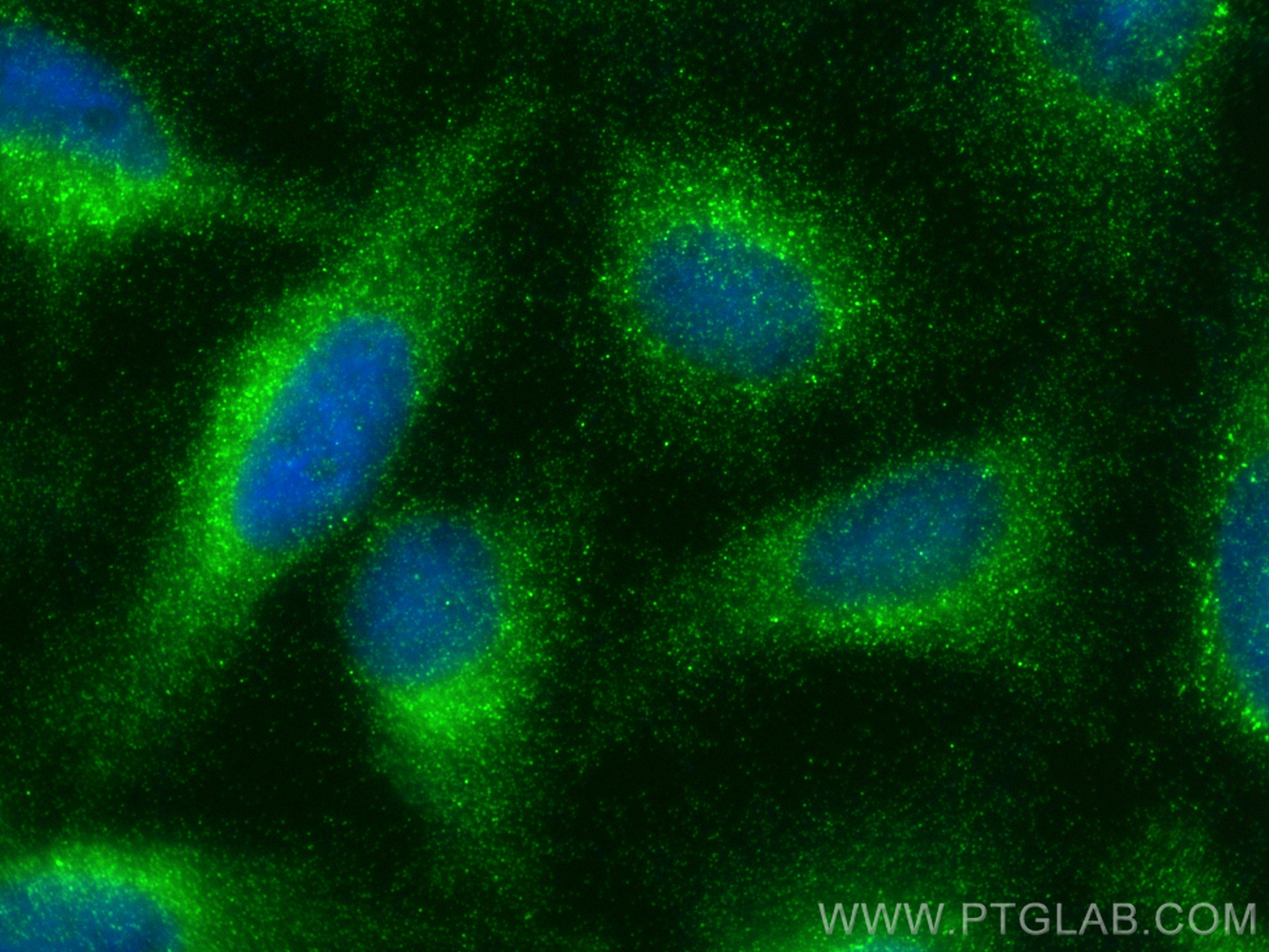 IF Staining of HeLa using 83428-1-RR