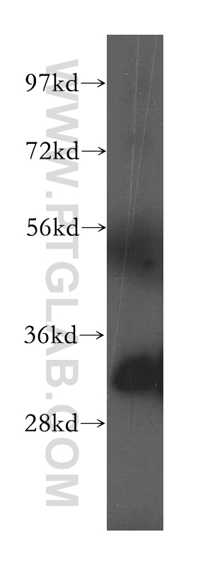 WB analysis of human heart using 51015-1-AP