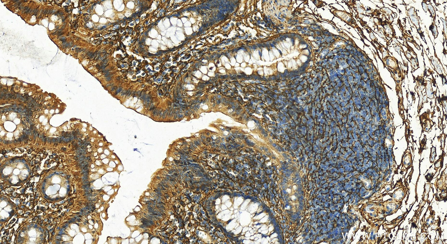 IHC staining of human normal colon using 29425-1-AP