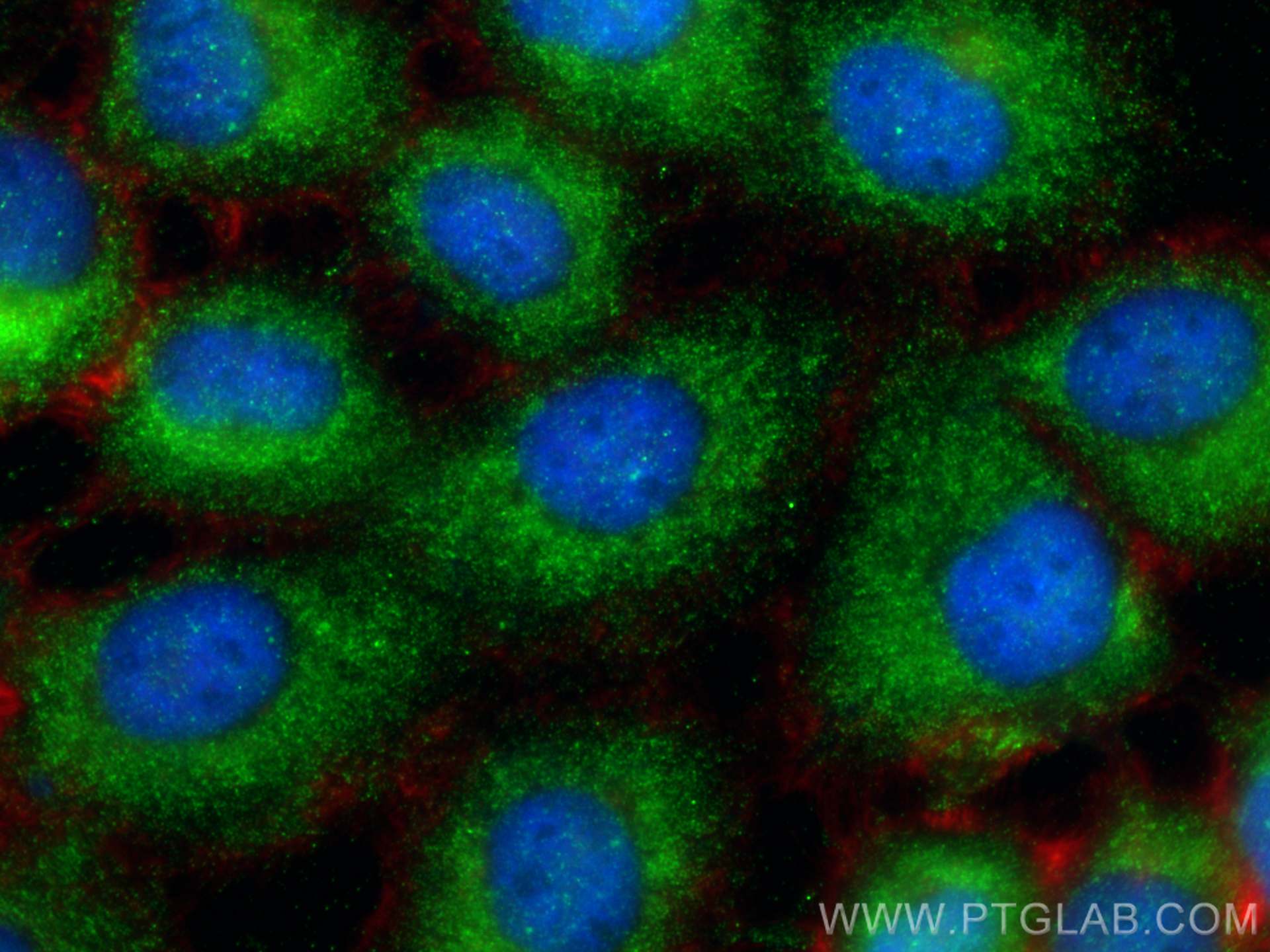 IF Staining of A431 using 29425-1-AP