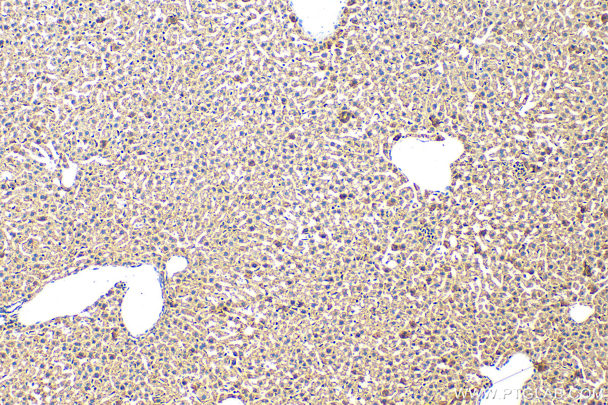 IHC staining of mouse liver using 27596-1-AP