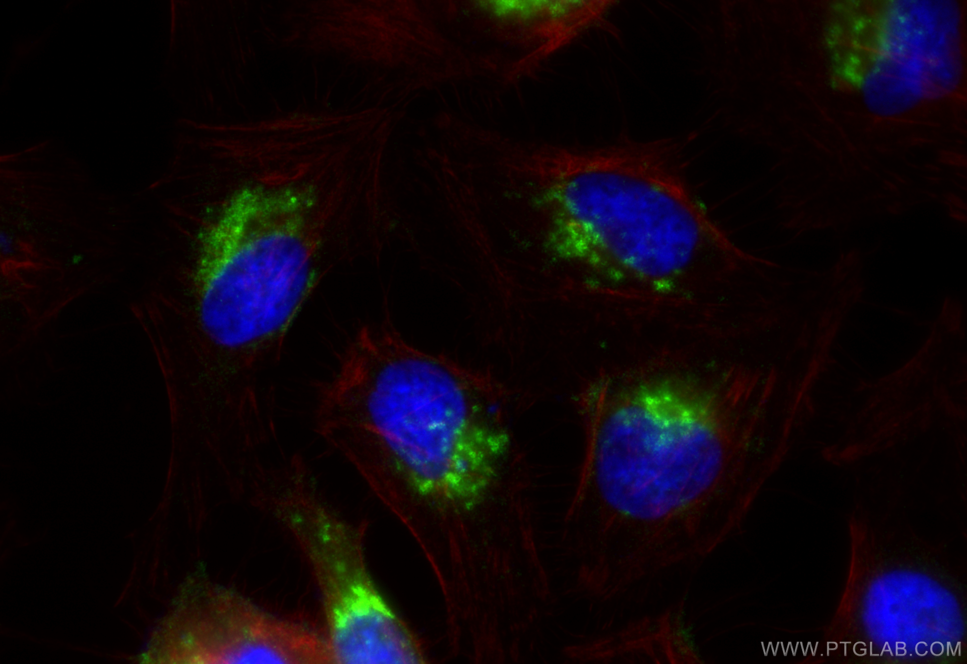 IF Staining of HeLa using 83598-4-RR (same clone as 83598-4-PBS)