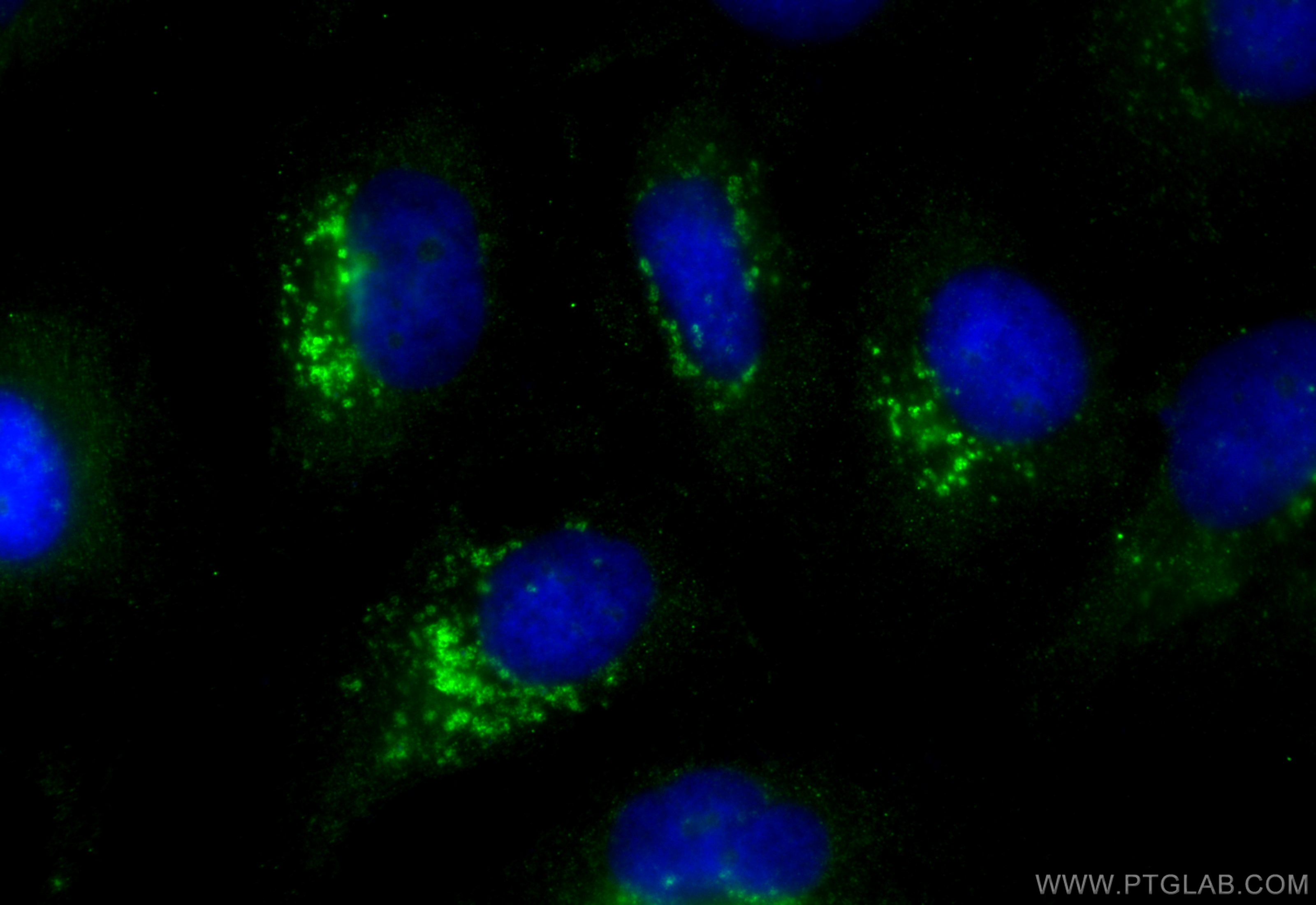 IF Staining of HeLa using CL488-83598-4