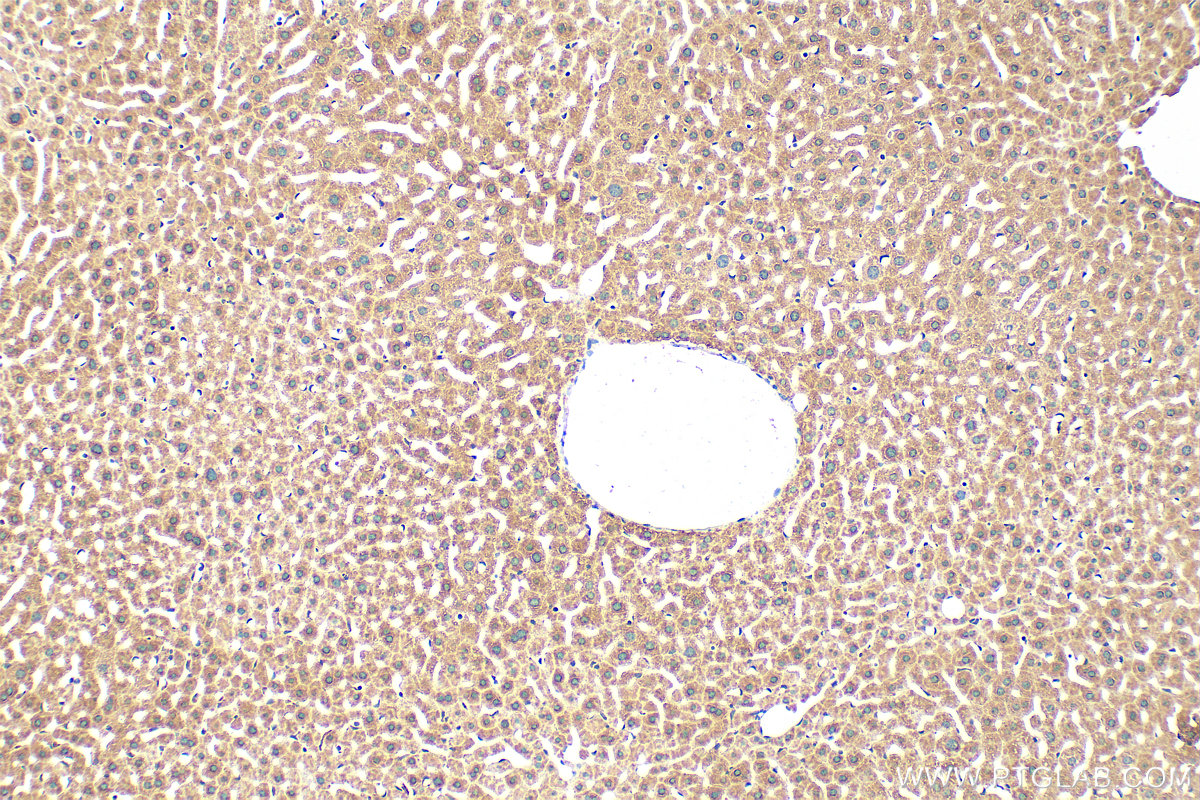 IHC staining of mouse liver using 12091-1-AP