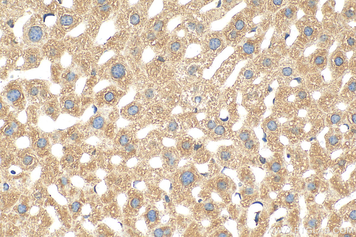 IHC staining of mouse liver using 12091-1-AP