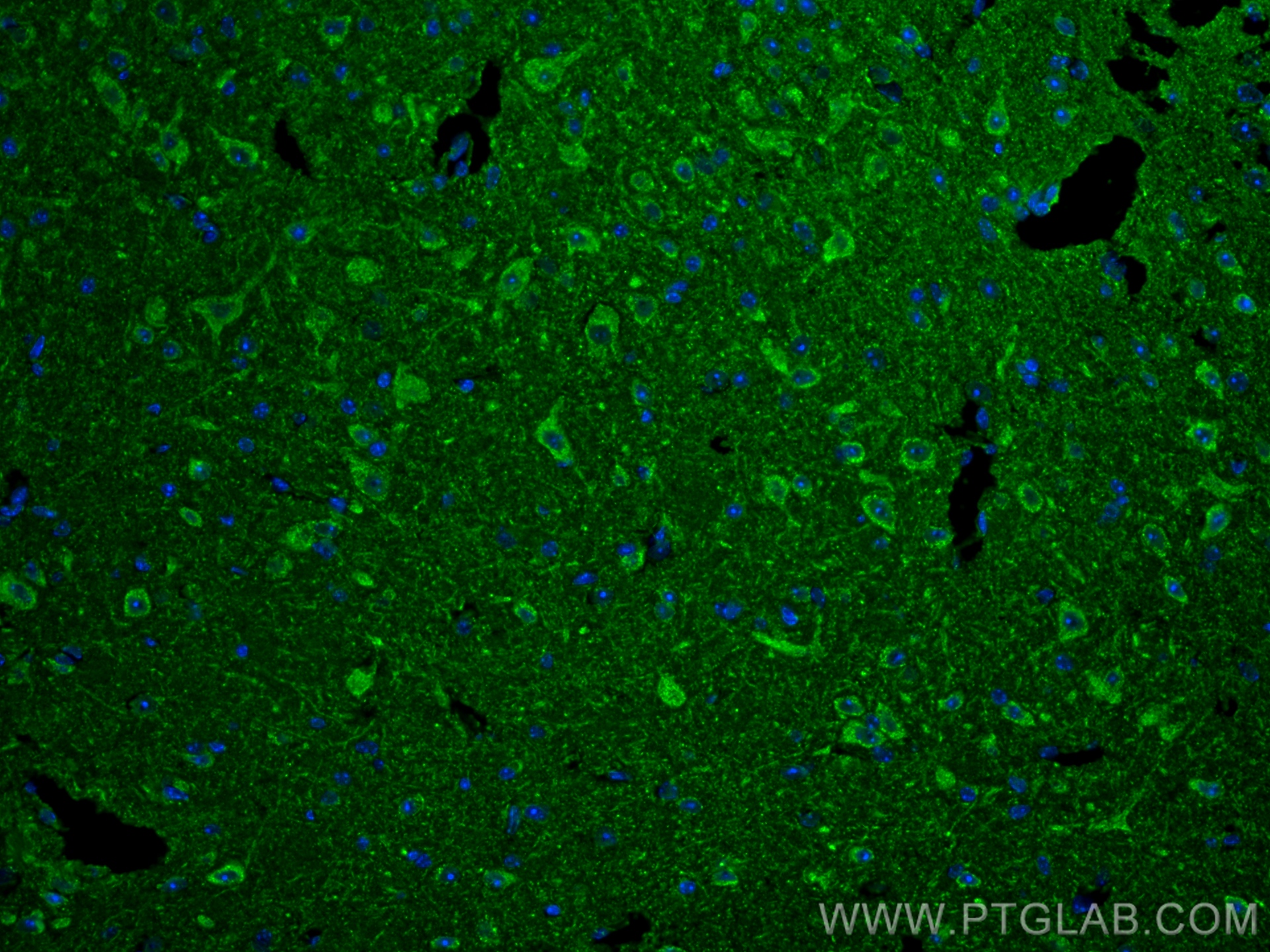 IF Staining of mouse brain using 80777-1-RR (same clone as 80777-1-PBS)