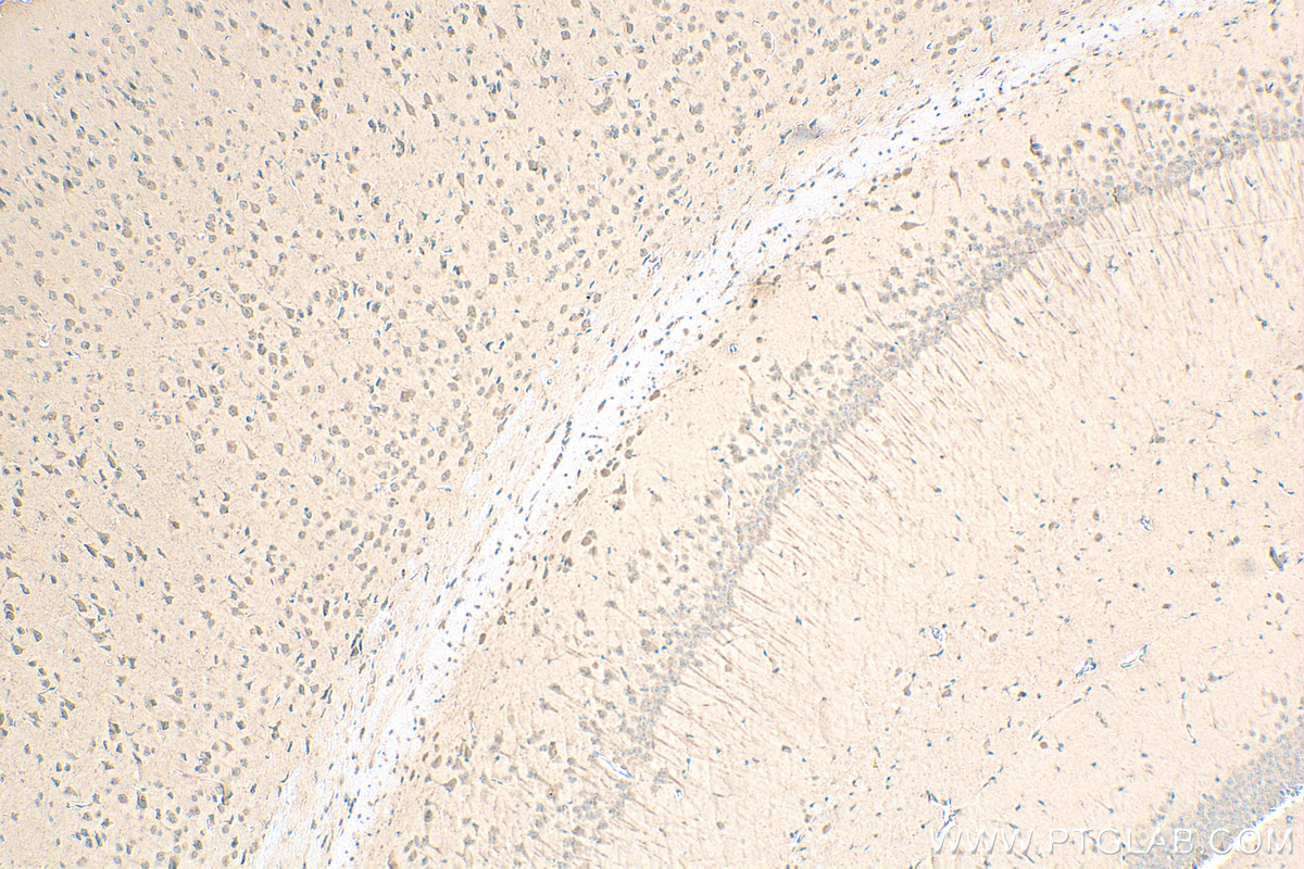 IHC staining of mouse brain using 80777-1-RR (same clone as 80777-1-PBS)