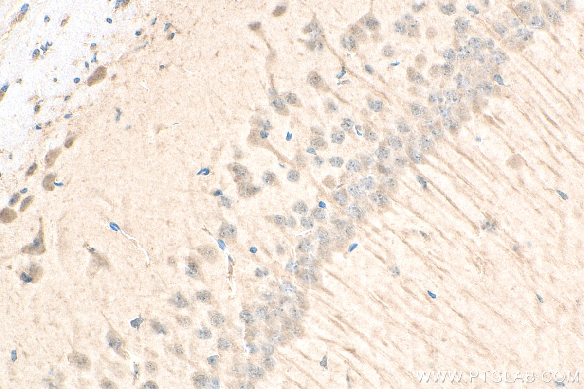 IHC staining of mouse brain using 80777-1-RR (same clone as 80777-1-PBS)