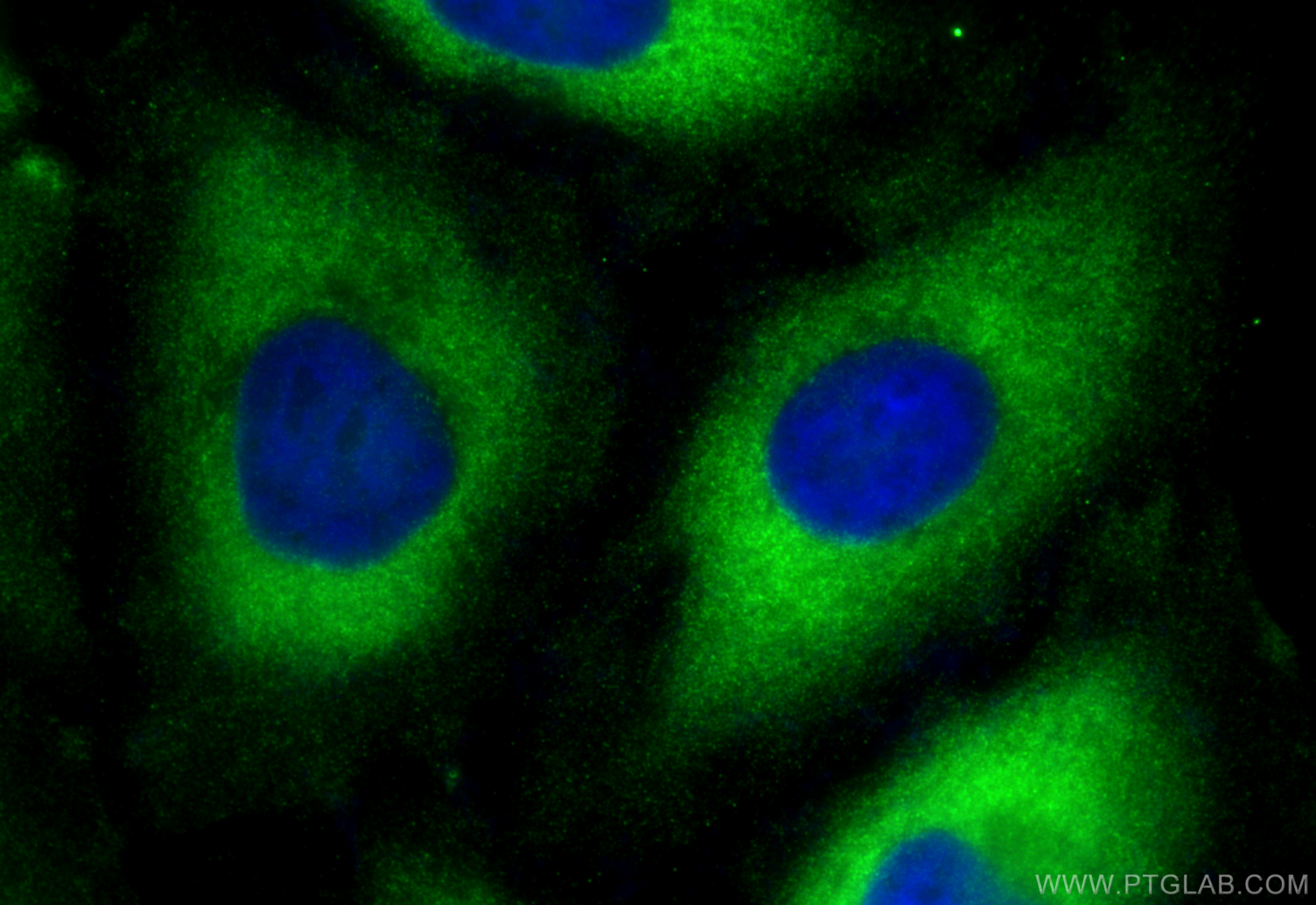 IF Staining of HeLa using 25413-1-AP