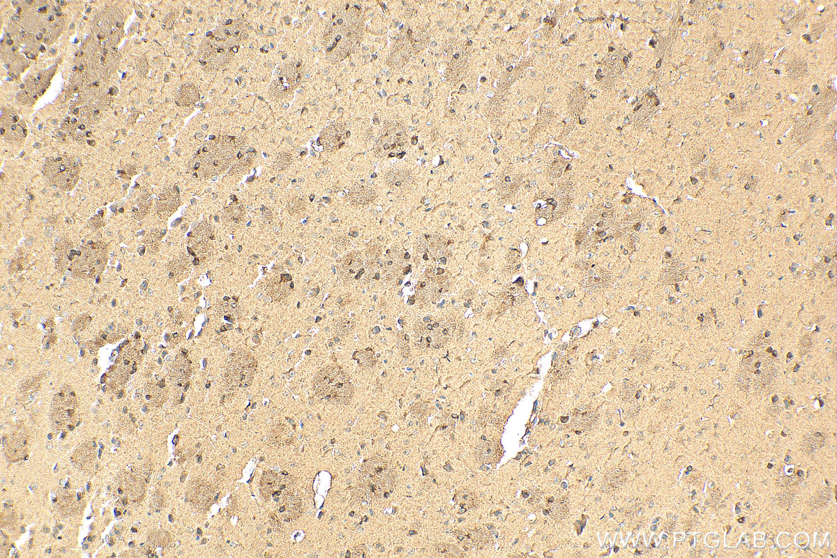 IHC staining of mouse brain using 26200-1-AP