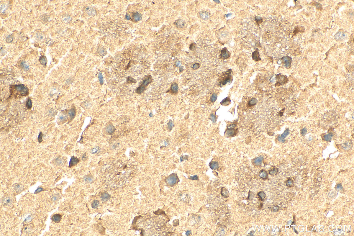 IHC staining of mouse brain using 26200-1-AP