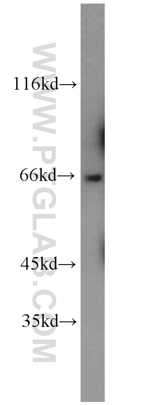 WB analysis of mouse brain using 20089-1-AP