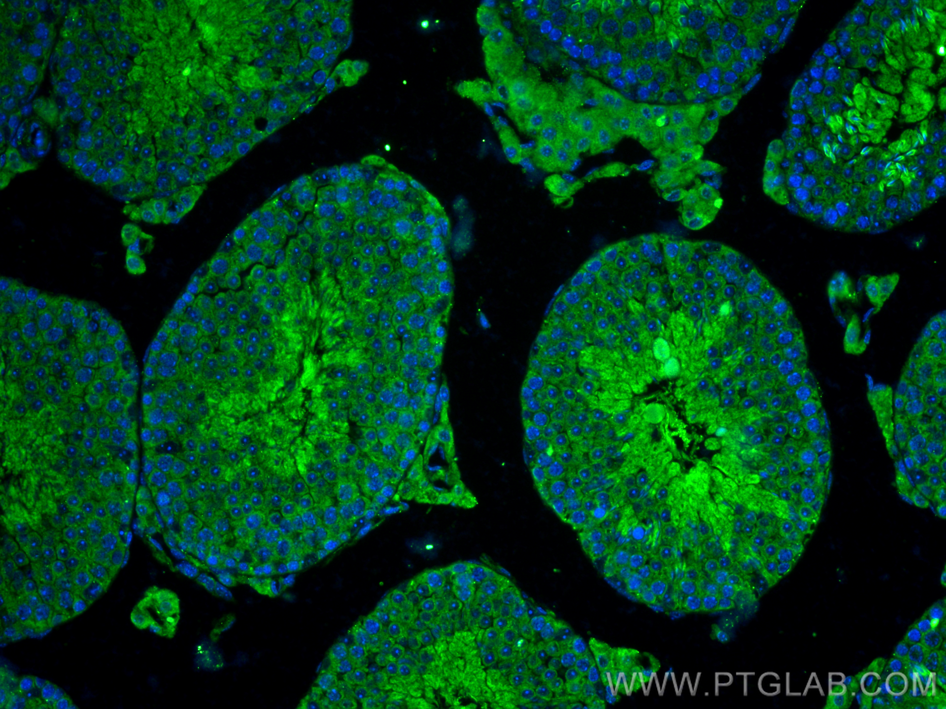 IF Staining of mouse testis using 20087-1-AP