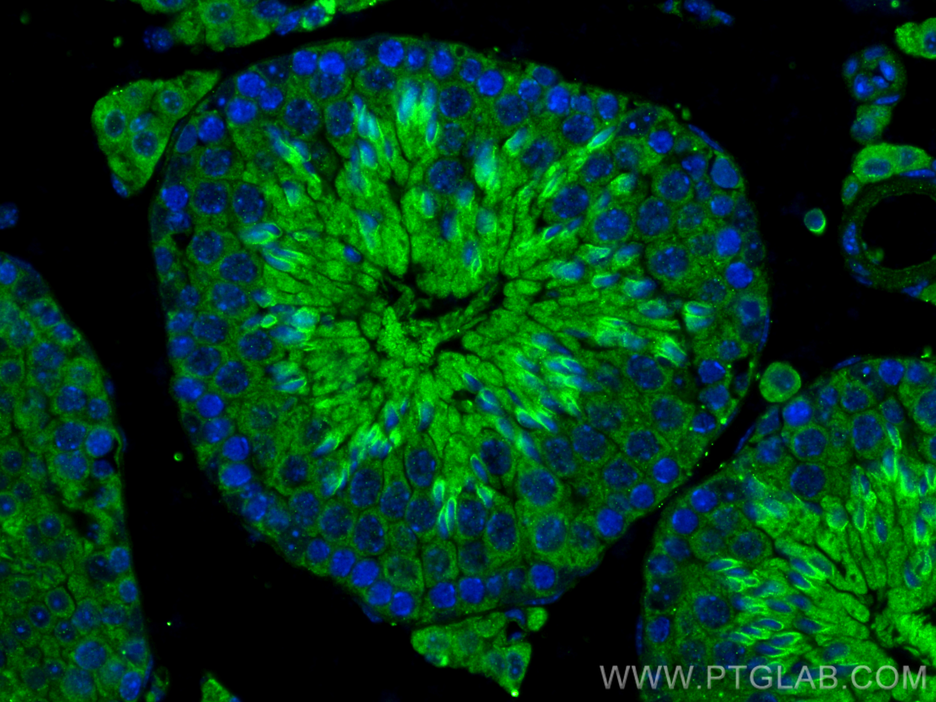 IF Staining of mouse testis using 20087-1-AP