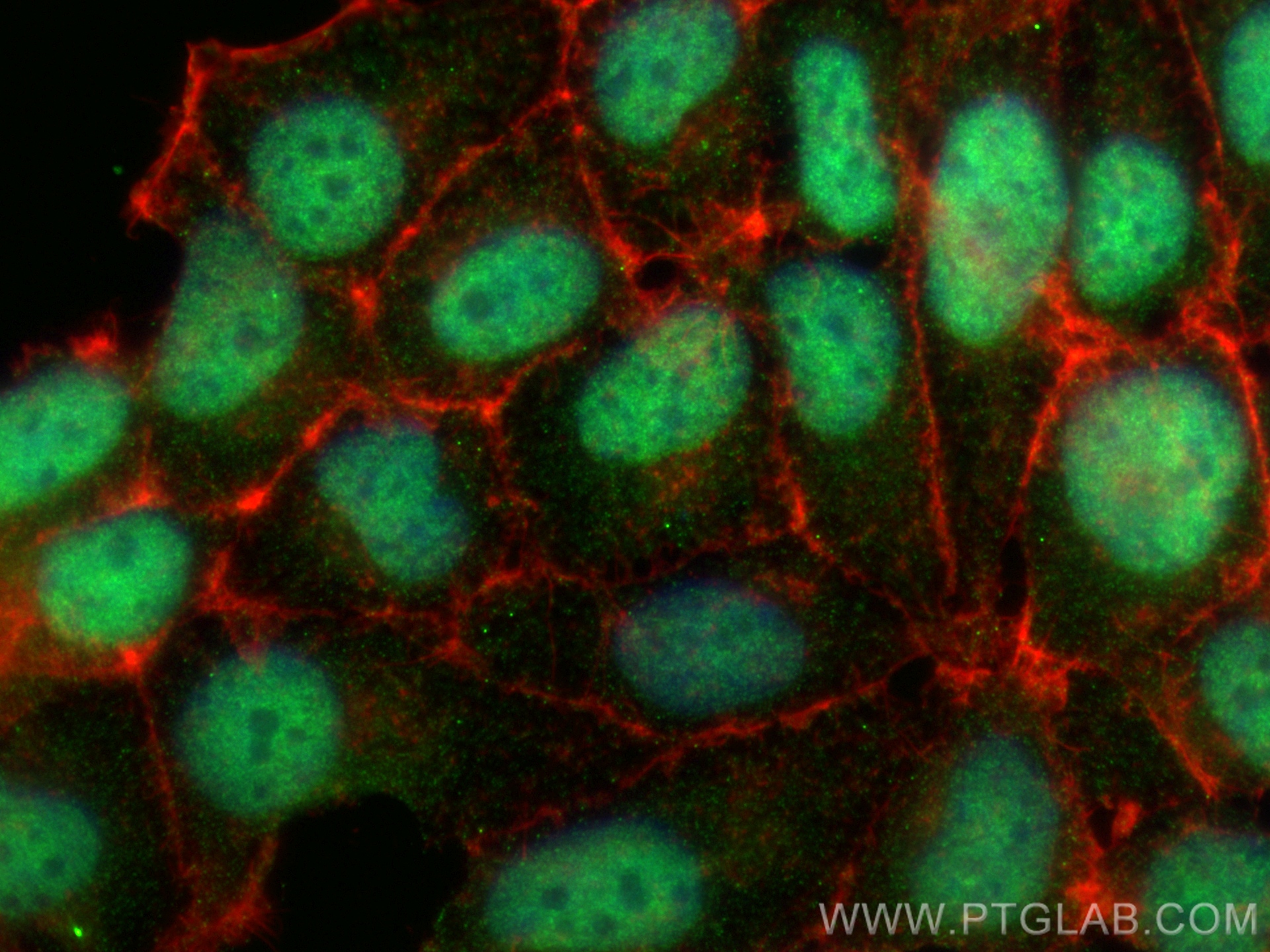 IF Staining of HEK-293 using 68645-1-Ig (same clone as 68645-1-PBS)