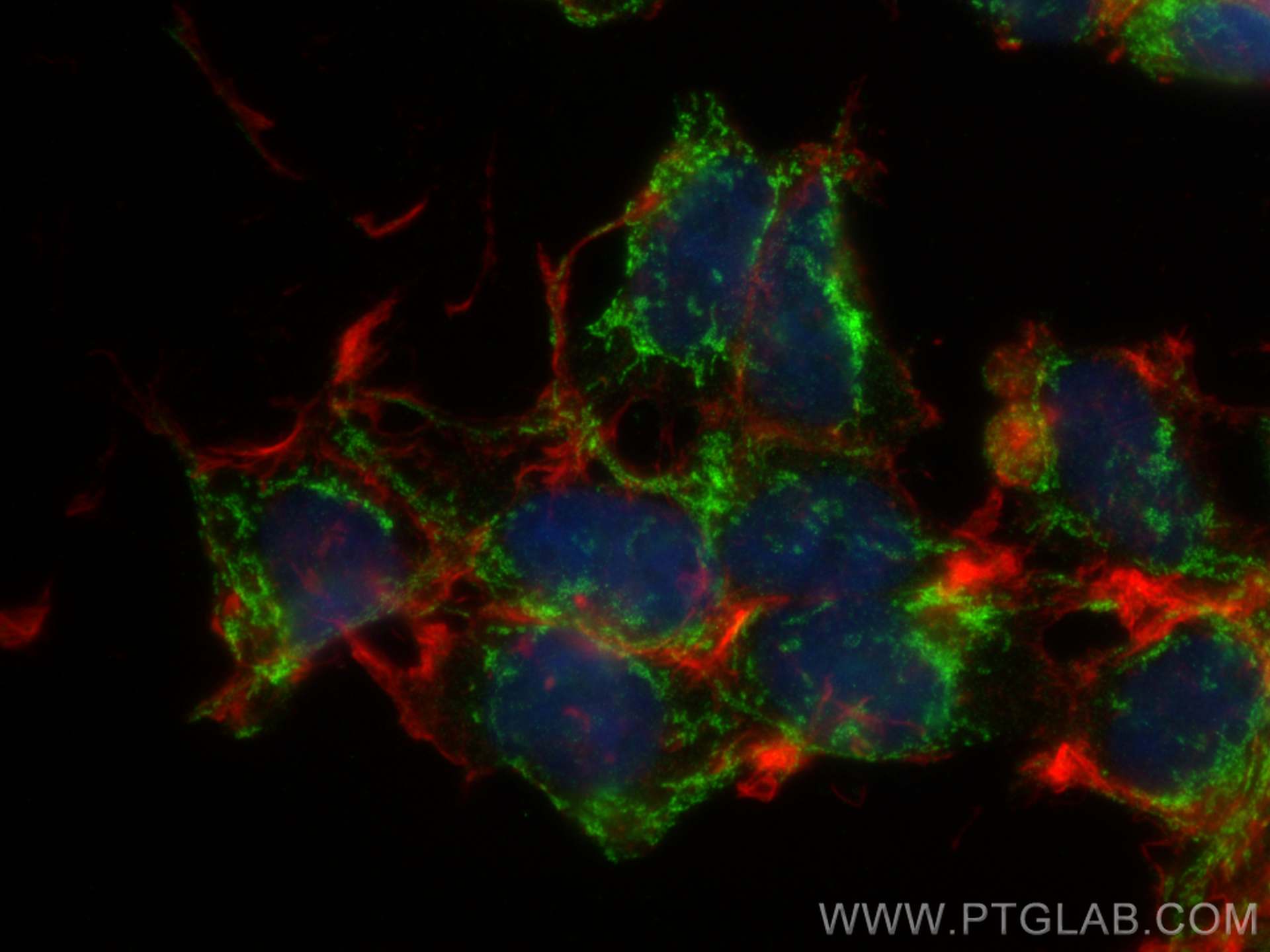 IF Staining of HEK-293 using 19958-1-AP (same clone as 19958-1-PBS)