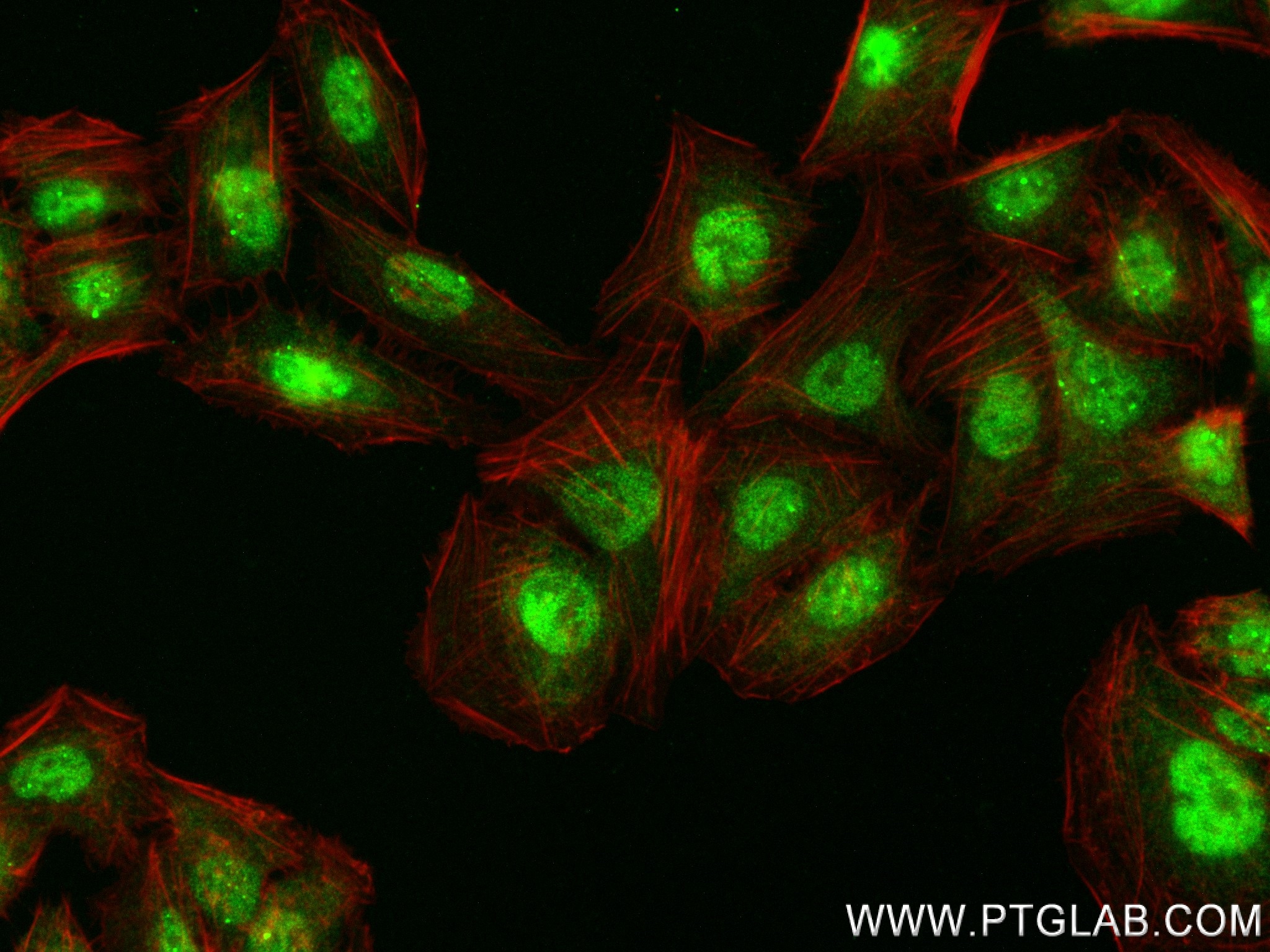 IF Staining of U2OS using 84376-3-RR (same clone as 84376-3-PBS)