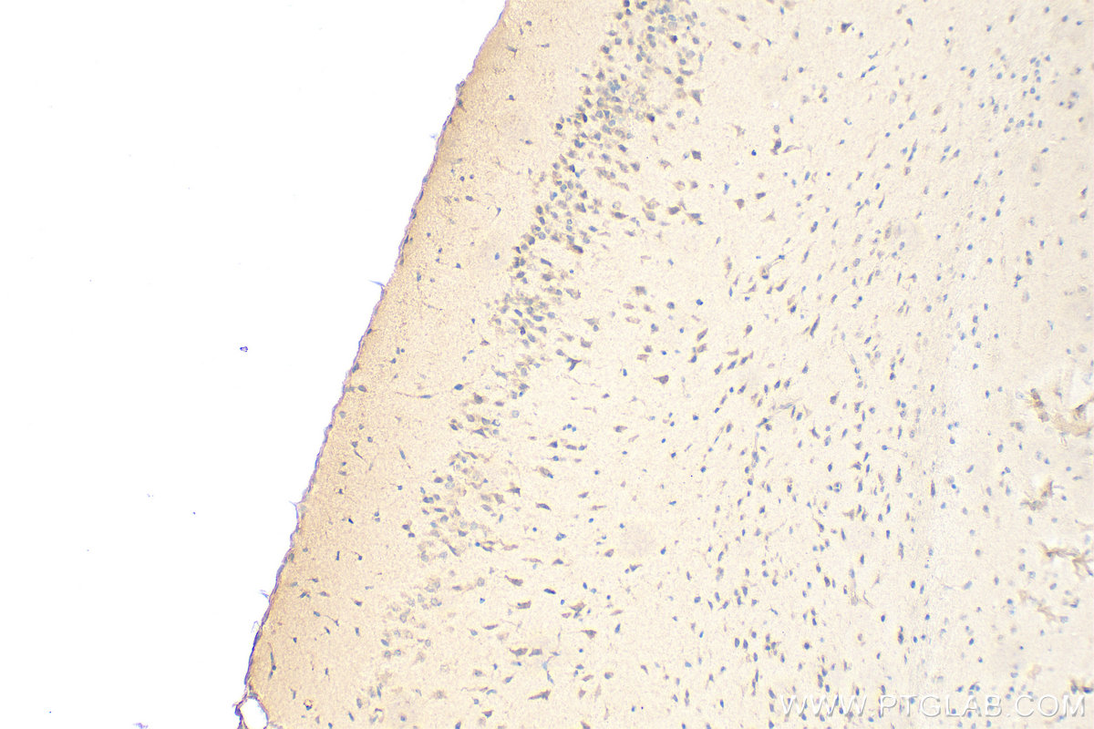 IHC staining of mouse brain using 16260-1-AP