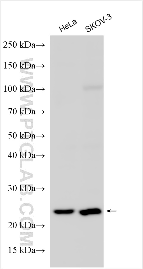 WB analysis using 16260-1-AP