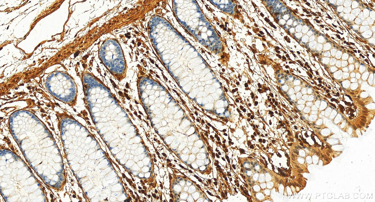 IHC staining of human colon using 11858-1-AP (same clone as 11858-1-PBS)