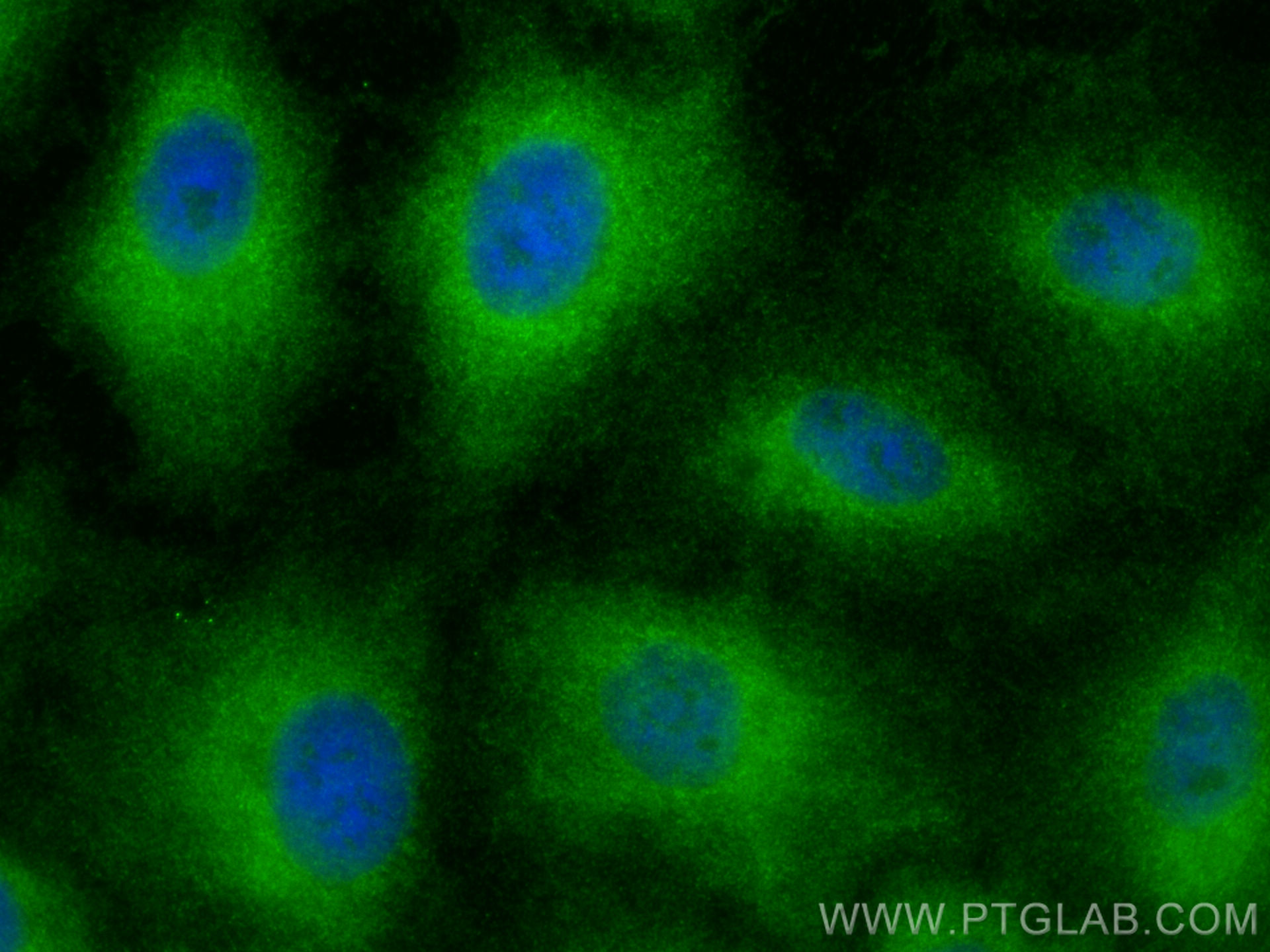 IF Staining of A549 using 11858-1-AP (same clone as 11858-1-PBS)