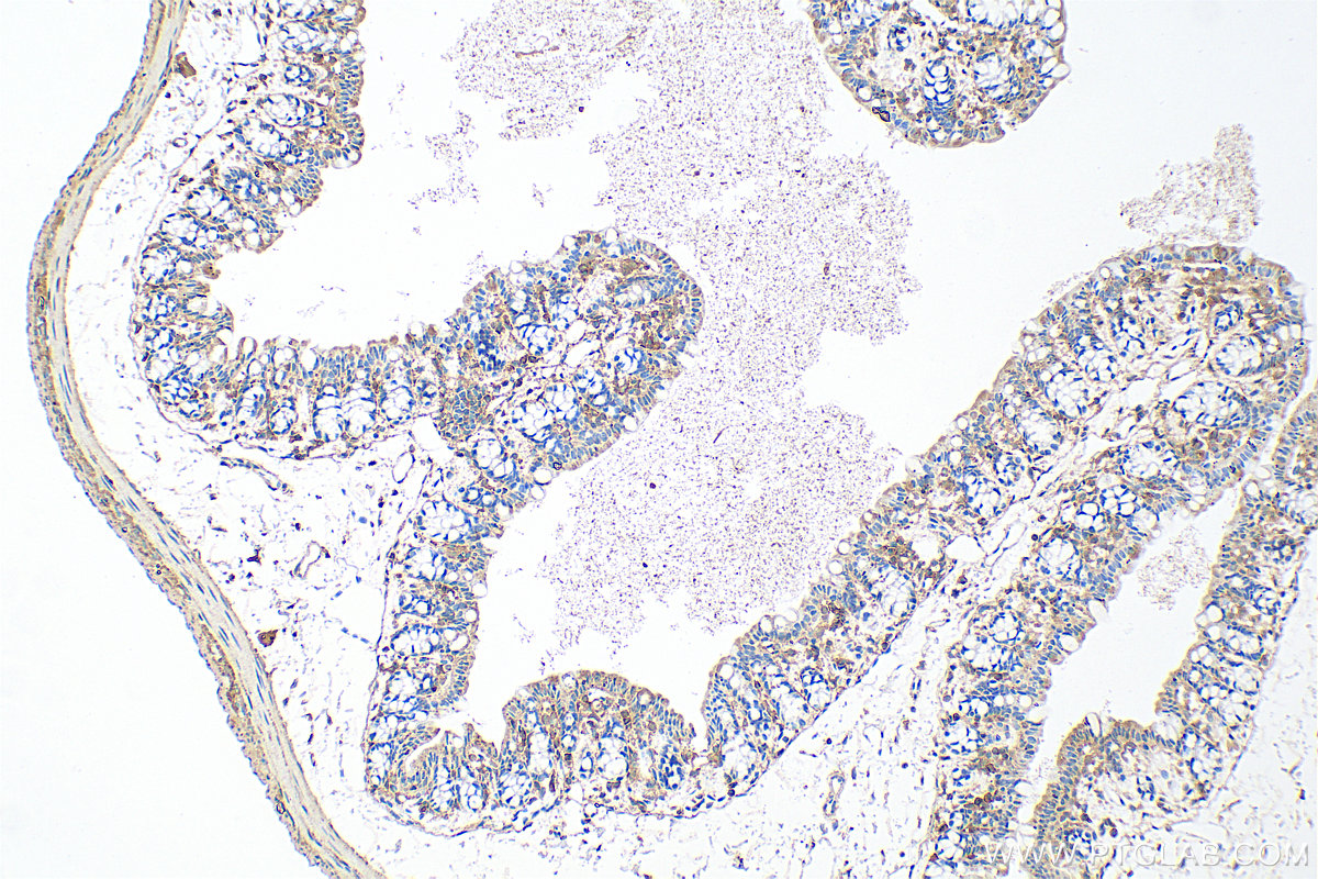 IHC staining of mouse colon using 11858-1-AP (same clone as 11858-1-PBS)