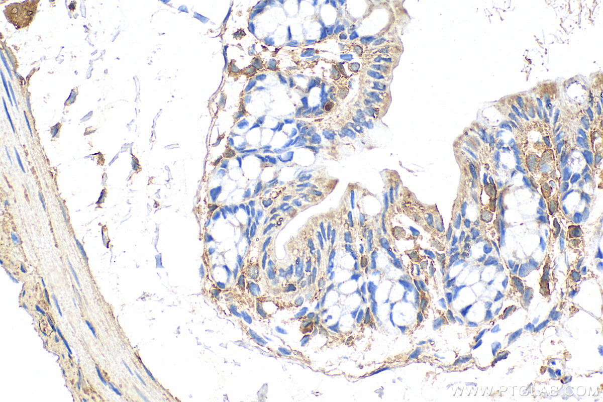 IHC staining of mouse colon using 11858-1-AP (same clone as 11858-1-PBS)