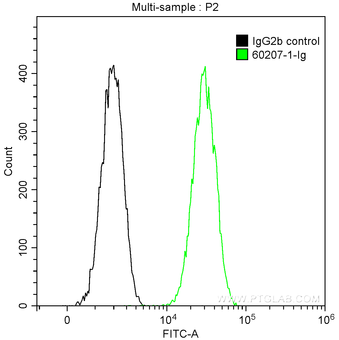 Galectin-3