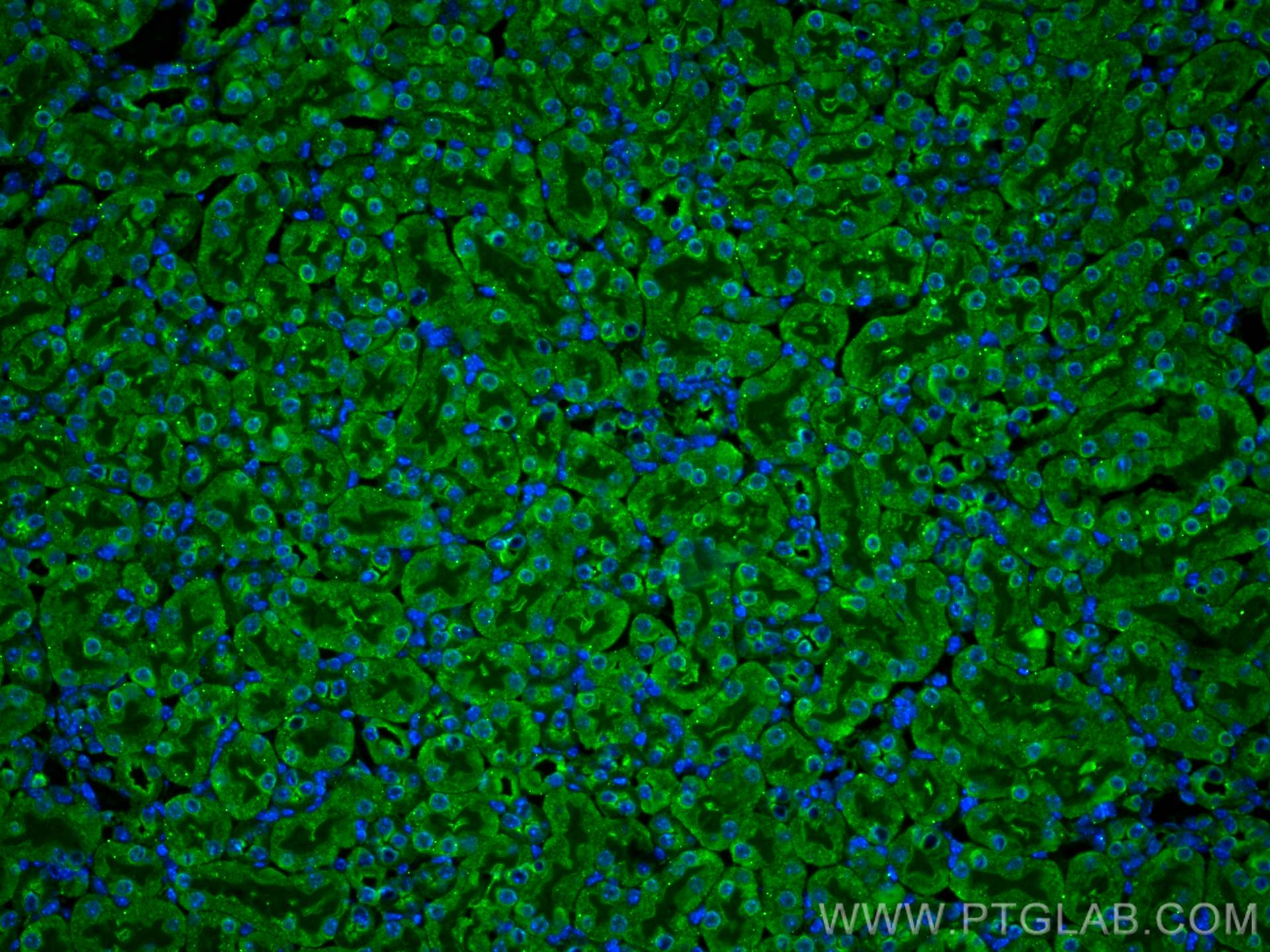 IF Staining of mouse kidney using 60207-1-Ig