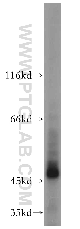 WB analysis of mouse testis using 18503-1-AP