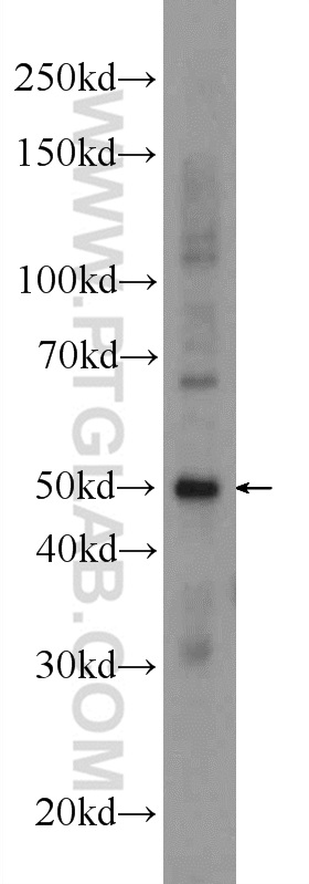 WB analysis of mouse brain using 24851-1-AP