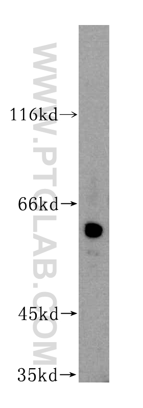 WB analysis of human placenta using 16240-1-AP