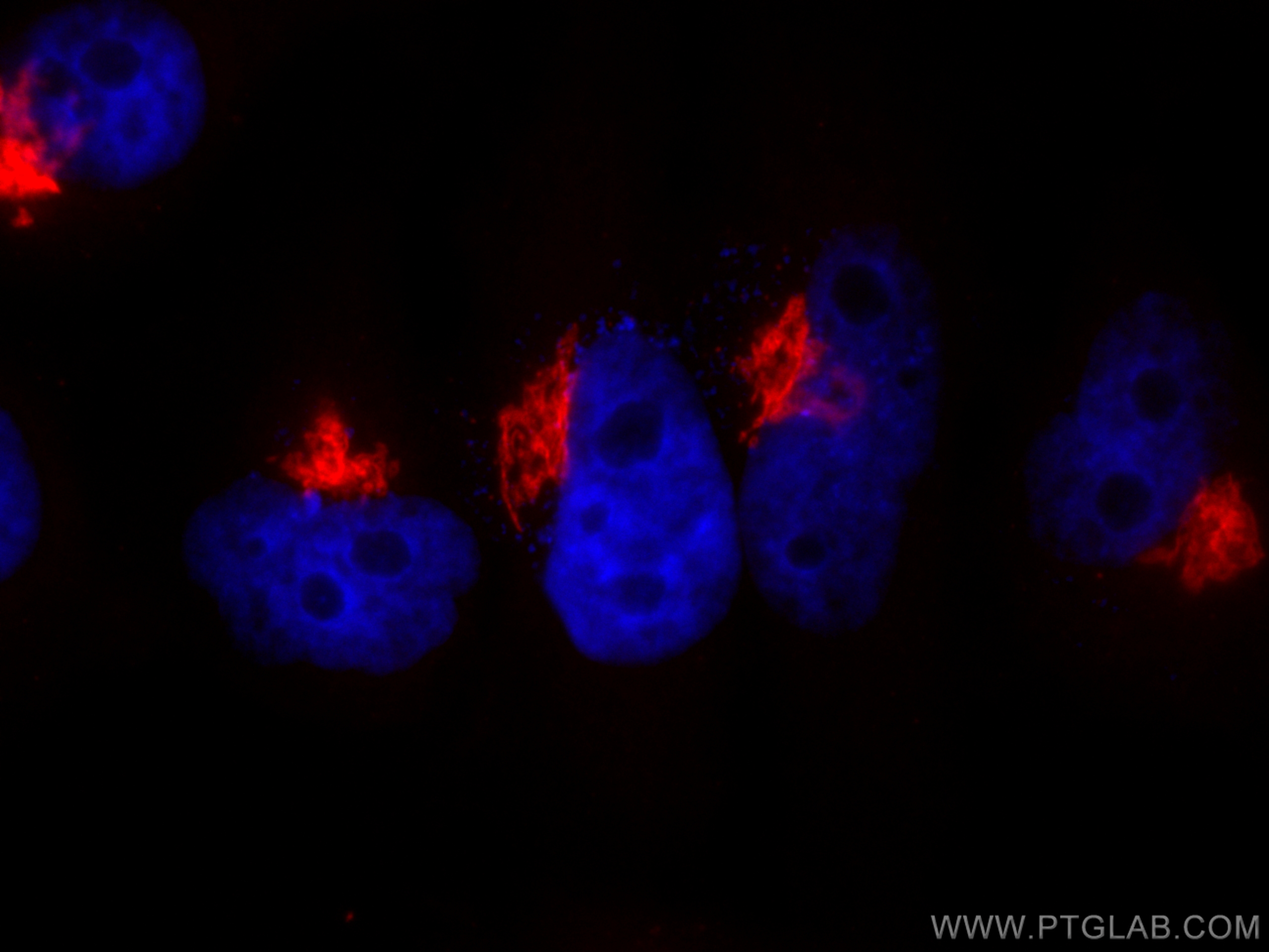 IF Staining of HeLa using CL594-17441