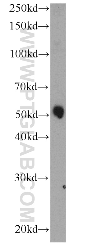 WB analysis of human placenta using 17131-1-AP