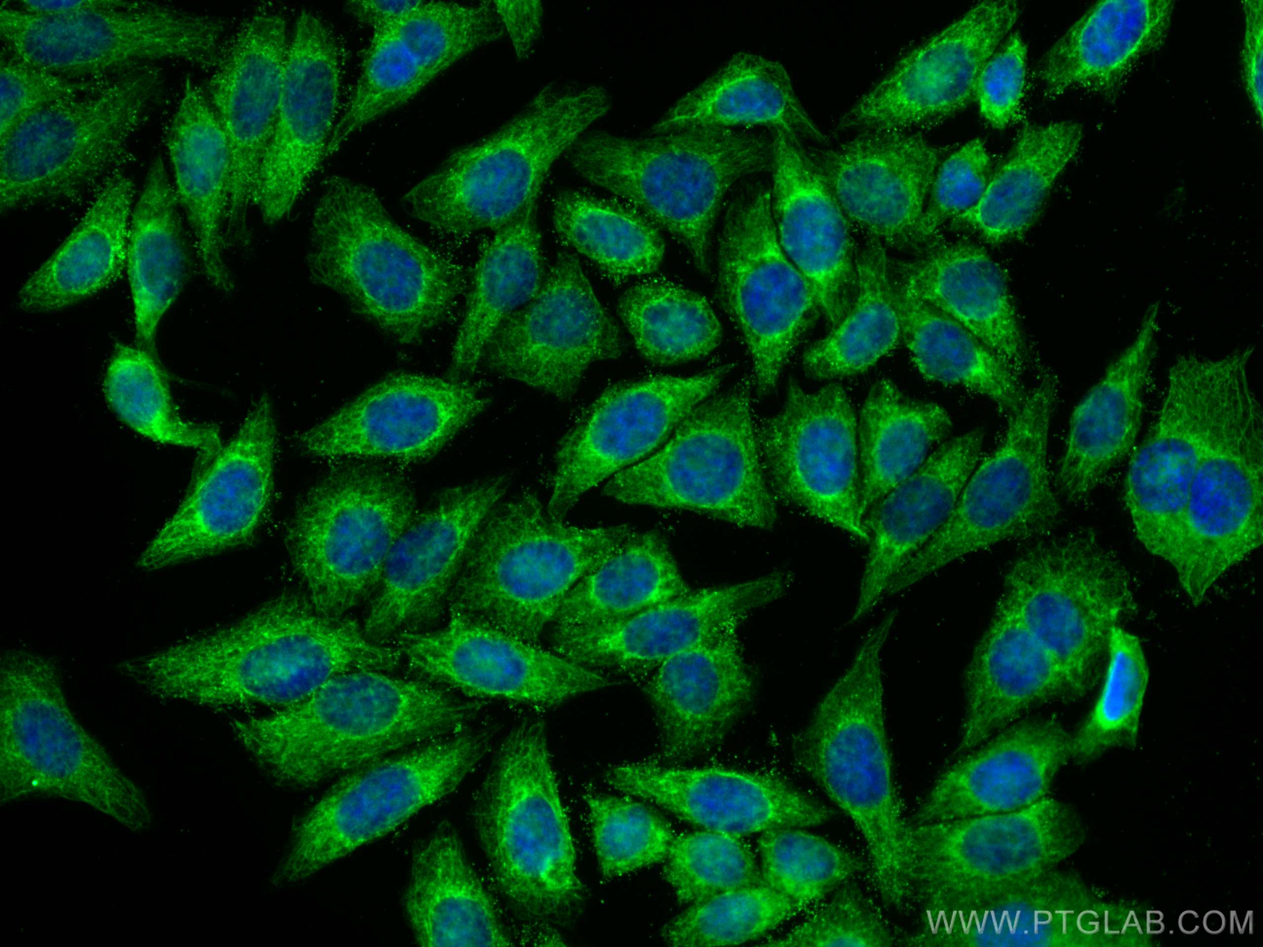 IF Staining of HepG2 using 29909-1-AP