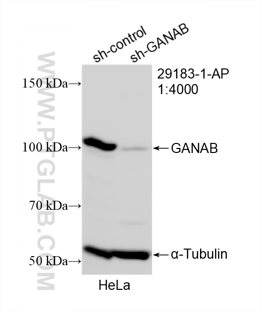 WB analysis of HeLa using 29183-1-AP