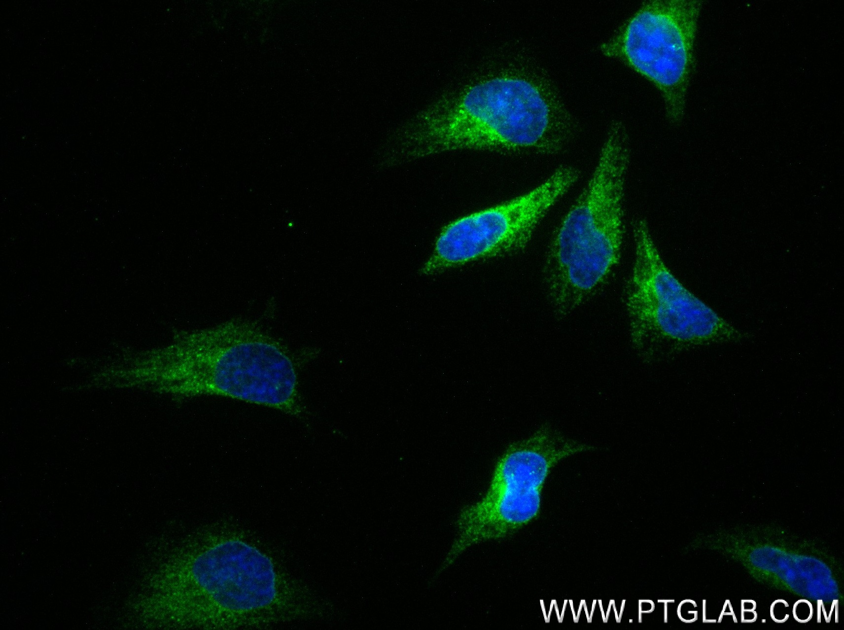 IF Staining of HeLa using 83324-1-RR (same clone as 83324-1-PBS)