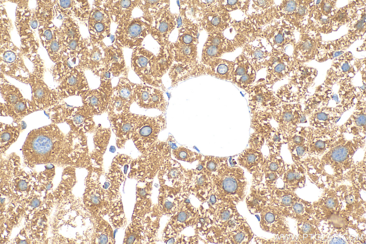 IHC staining of mouse liver using 83324-1-RR (same clone as 83324-1-PBS)