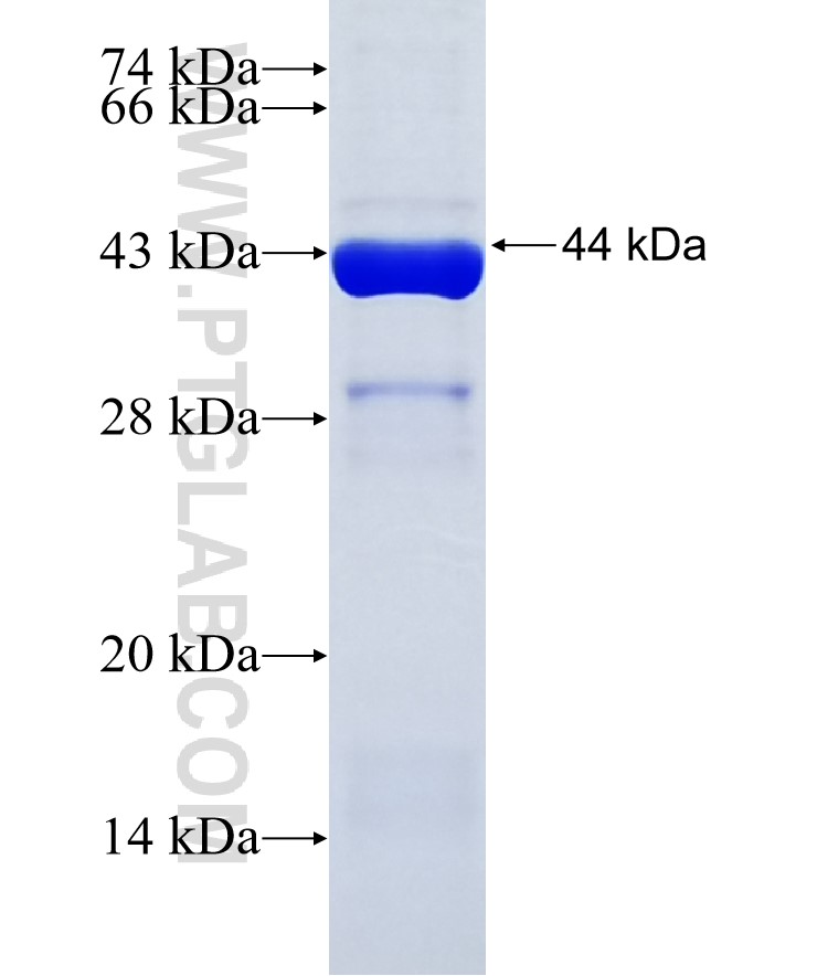 GANC fusion protein Ag35067 SDS-PAGE