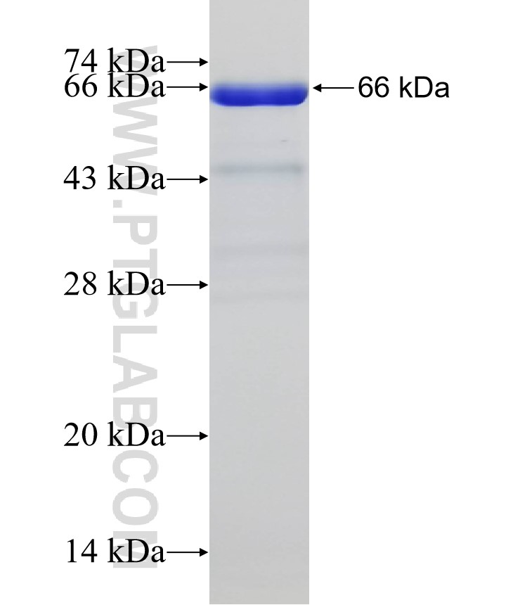 GAP43 fusion protein Ag31856 SDS-PAGE