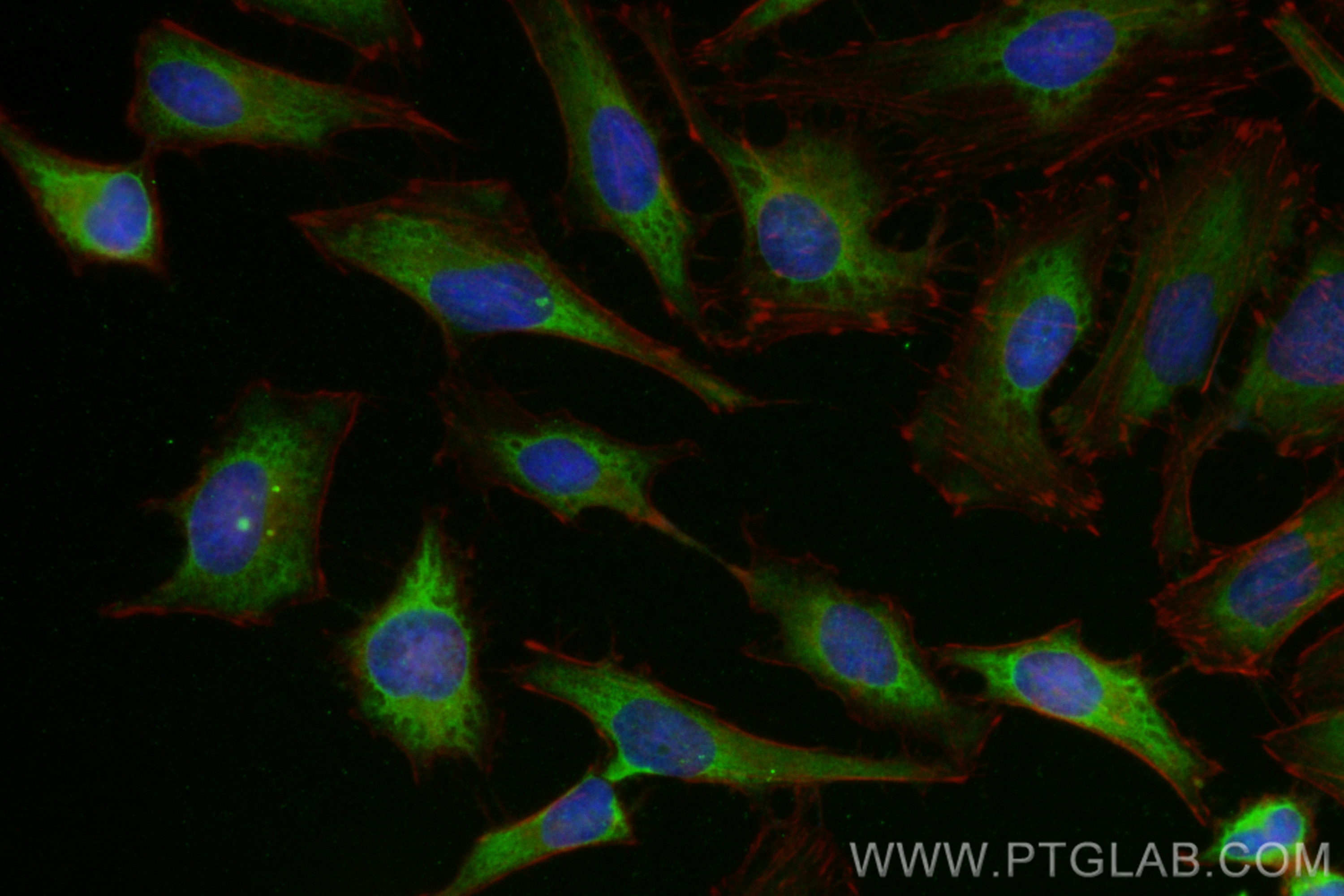 IF Staining of HeLa using CL488-81640-5