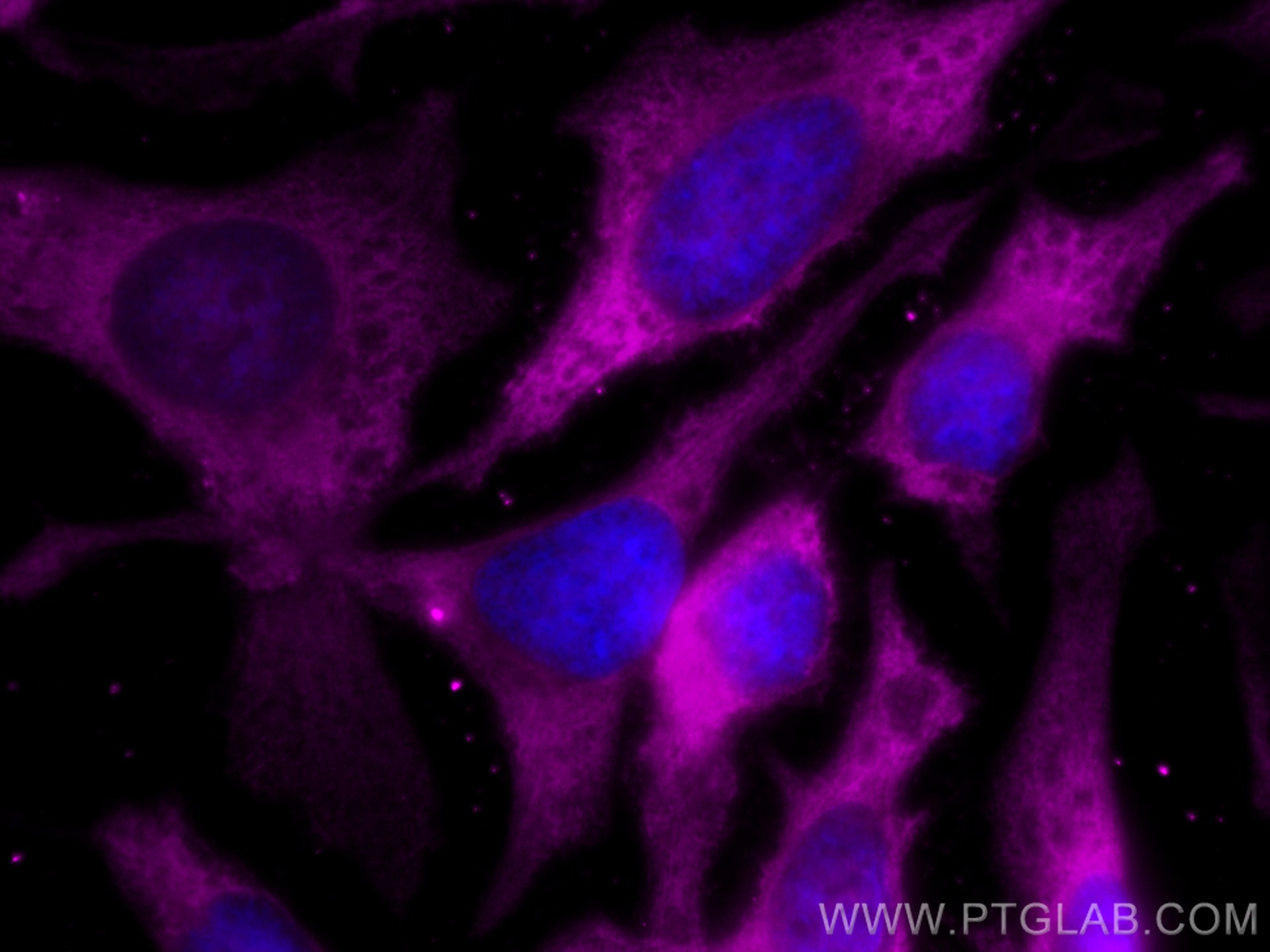 IF Staining of HeLa using CL647-80570