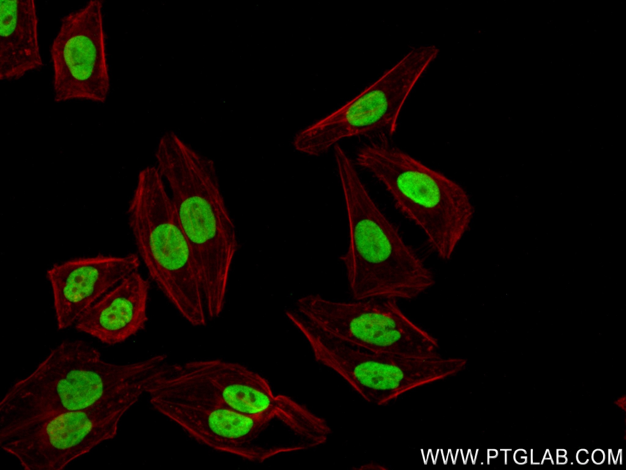 IF Staining of HepG2 using 83577-1-RR (same clone as 83577-1-PBS)