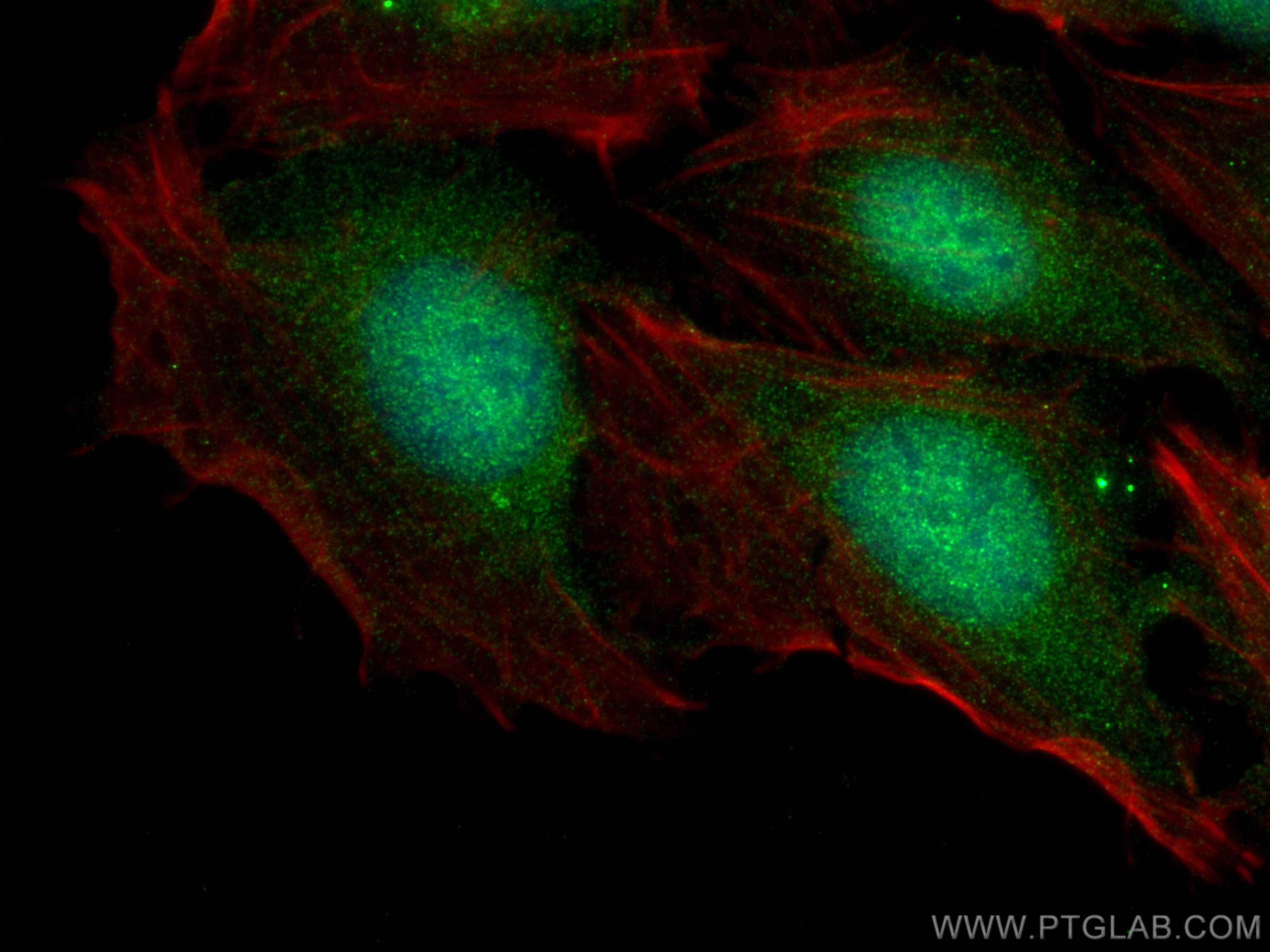 IF Staining of U2OS using 29847-1-AP