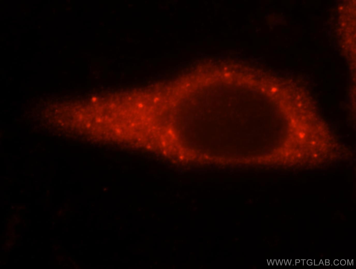 IF Staining of HepG2 using 15831-1-AP