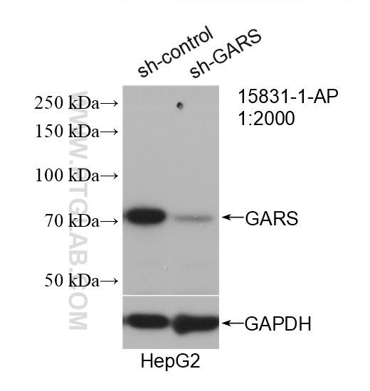 WB analysis of HepG2 using 15831-1-AP