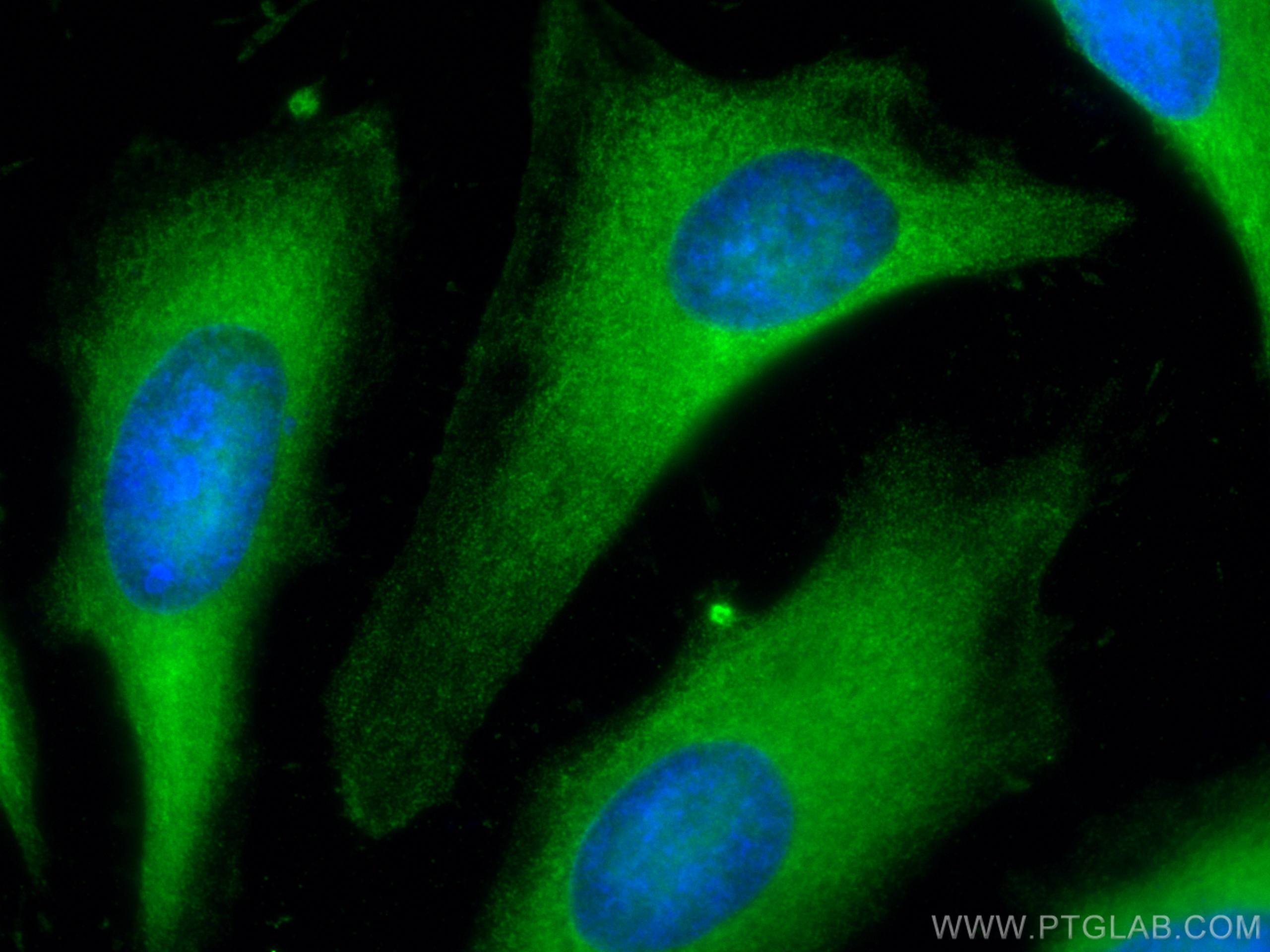 IF Staining of HeLa using 67939-1-Ig (same clone as 67939-1-PBS)