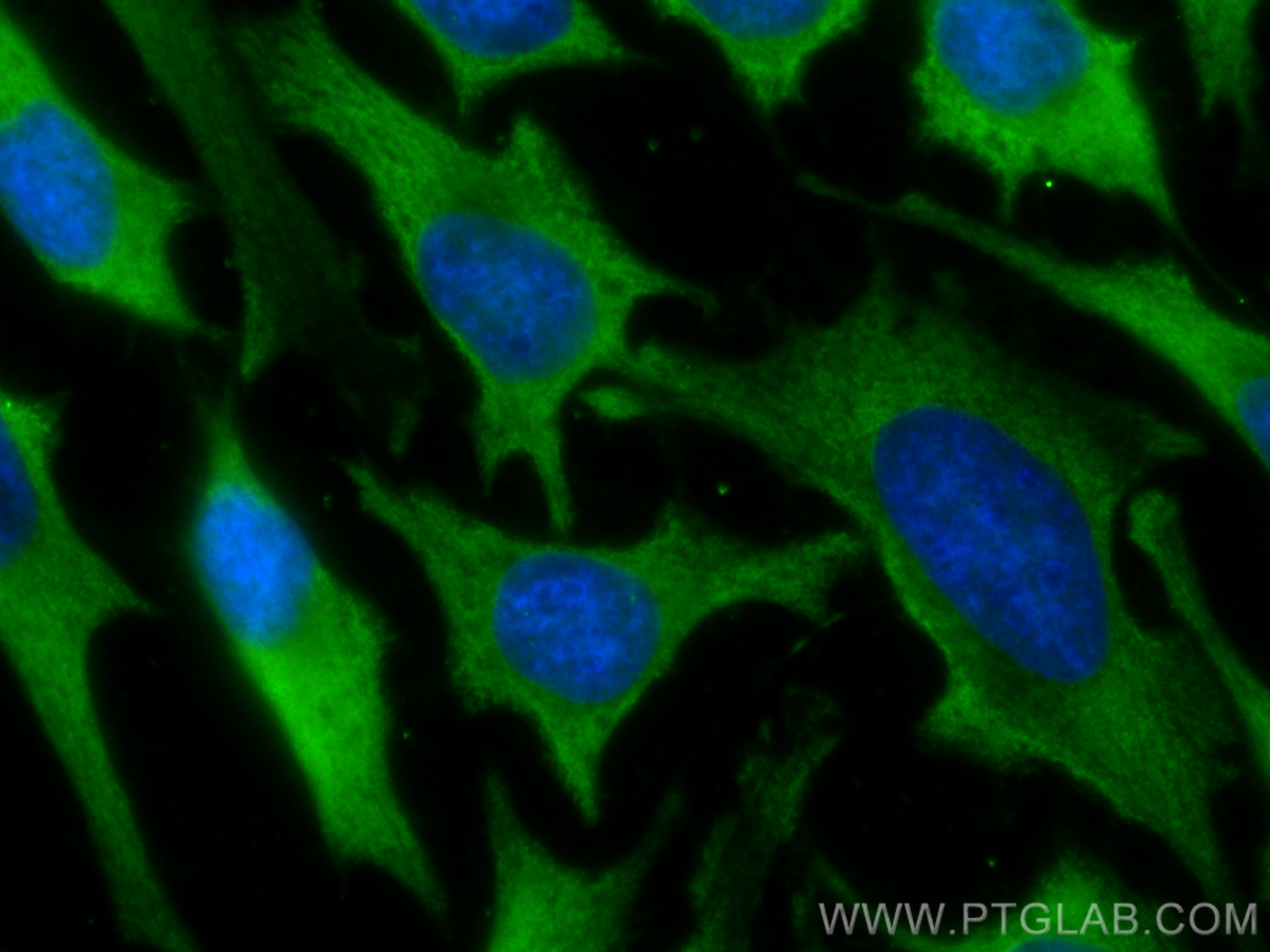 IF Staining of HeLa using CL488-67939